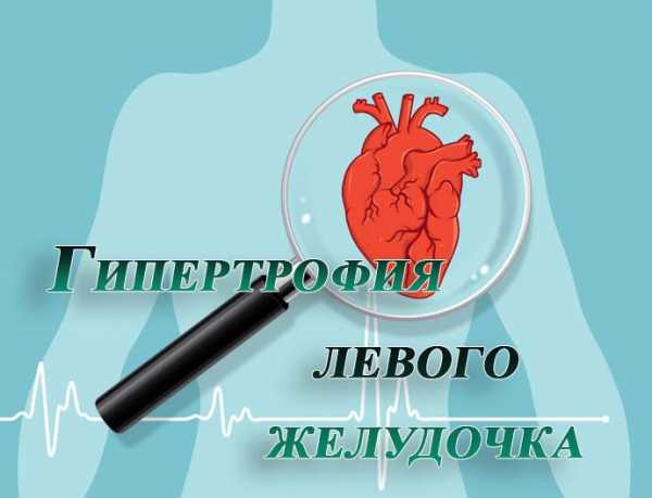 Гипертония левого желудочка сердца
