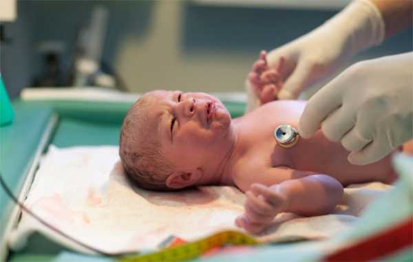 Гипоксия у новорожденного что это и последствия