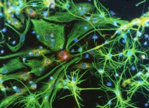 Лейкоциты в норме а лимфоциты повышены