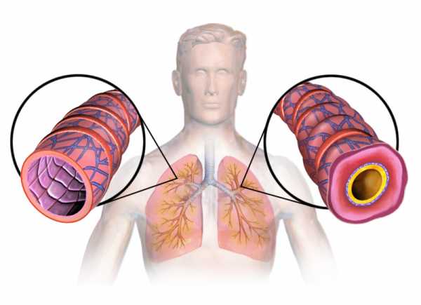 Средство от астмы