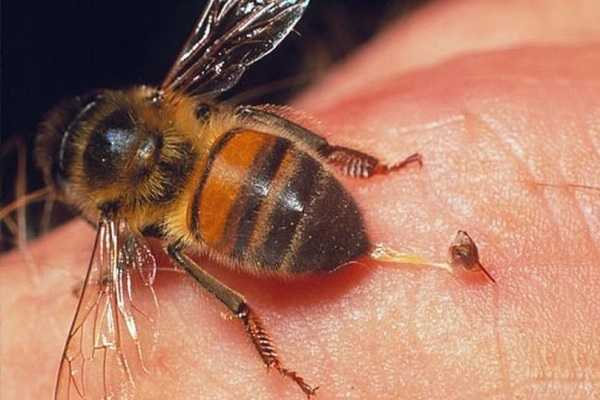 Укусы пчелы лечение чем снять опухоль