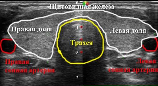 Ультразвуковая диагностика щитовидной железы