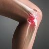 Лечение синовита коленного сустава: традиционные и нетрадиционные методы